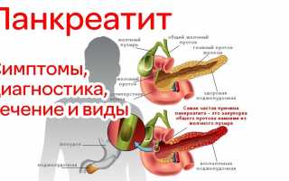 Признаки и симптомы панкреатита у женщин