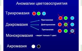 Аномалии (отклонение) цветового зрения: симптомы, причины и лечение