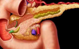 Что представляет из себя паренхиматозный панкреатит?