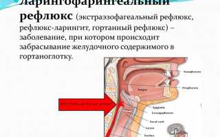 Как проявляется ларингофарингеальный рефлюкс и в чем его опасность