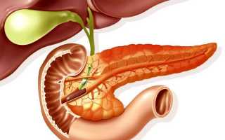 Особенности течения и лечения билиарного панкреатита