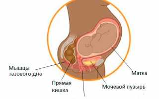 Причины недержания мочи при беременности: что делать и следует ли обратится к врачу?