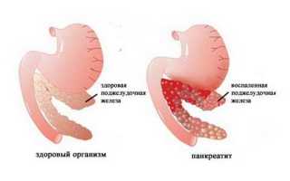Особенности развития панкреатита у детей