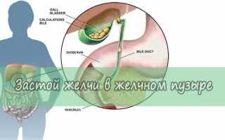 Что делать при застое желчи в желчном пузыре?
