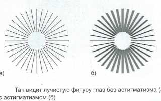 Берут ли в армию с астигматизмом