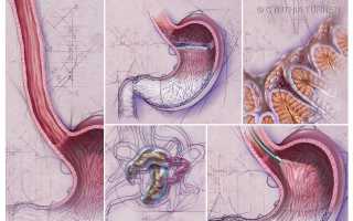 Почему возникает эрозия пищевода?