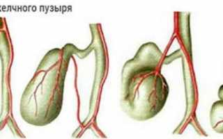 Почему возникает перетяжка желчного пузыря?