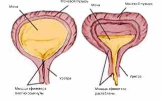 Основные причины вызывающие атонию мочевого пузыря у женщин и мужчин, симптомы болезни и методы лечения