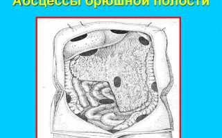 Почему возникает абсцесс брюшной полости?