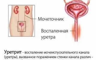 Как возникает проблема гипертрофии стенок мочевого пузыря и как ее лечить