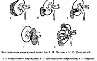 Виды и типы ушибов почки: причины и факторы риска