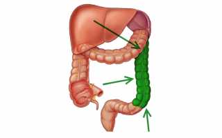 Где находится ободочная кишка?