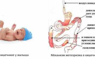 Почему бывает метеоризм у грудничка и что с этим делать?