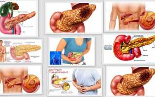 Какие симптомы панкреатита у взрослых?