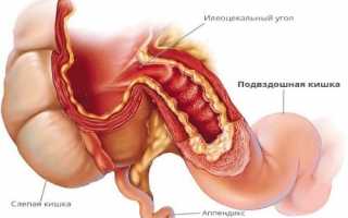 Функции и заболевания подвздошной кишки